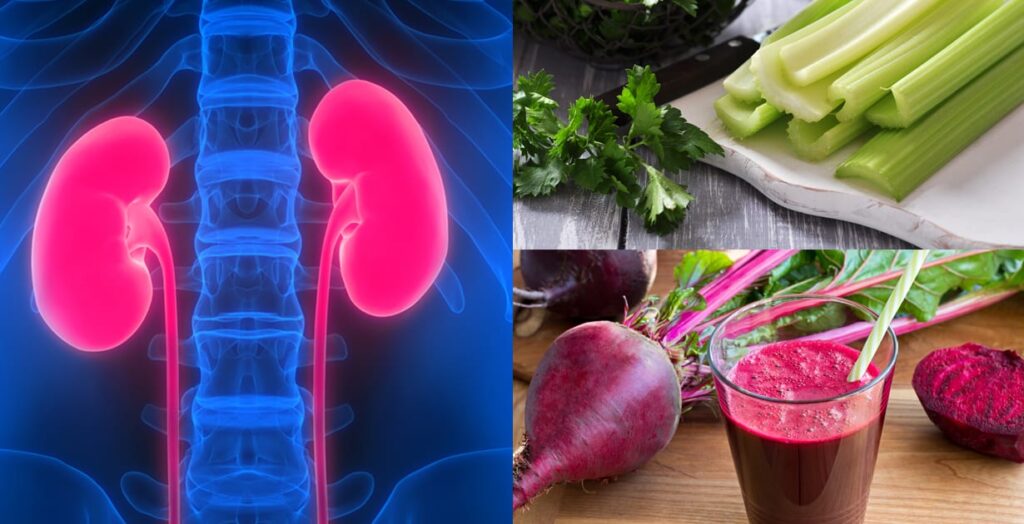 Top 3 Vegan Foods for a Kidney Stone-Free Life
